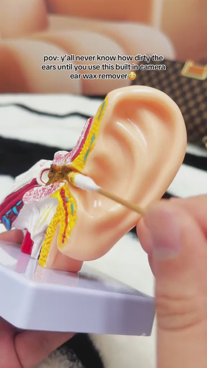 Premium Wireless Ear Cleaner with HD Camera & LED Light Kit